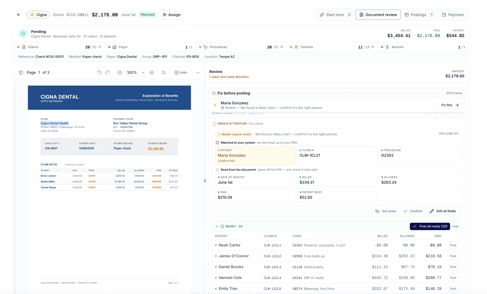 ScoutIQ document review: a Cigna EOB read side by side with extracted claim lines, each field verified against the PMS with confidence indicators and one line flagged for quick human confirmation